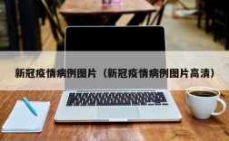 新冠疫情病例图片（新冠疫情病例图片高清）